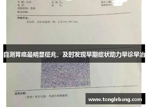 自测胃癌最明显征兆，及时发现早期症状助力早诊早治