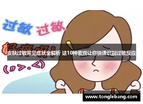 皮肤过敏常见症状全解析 这10种表现让你快速识别过敏反应